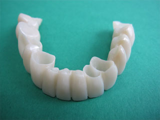 Bridge zirconium sans métal